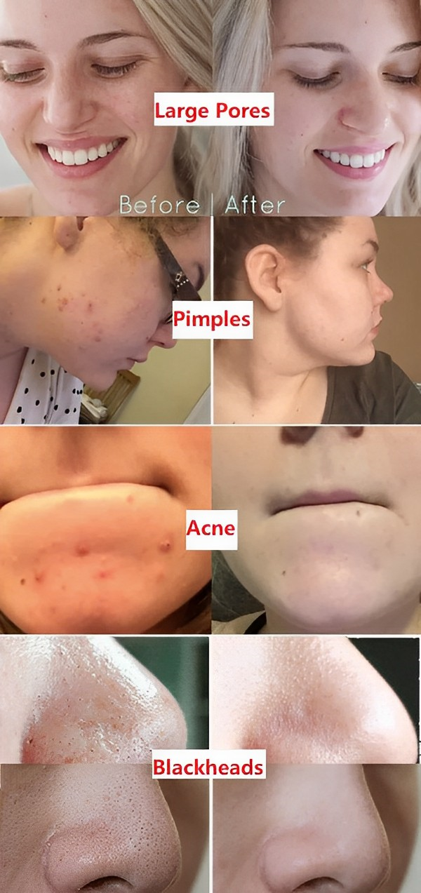 GreenTea Glow Reinigungsstick zur Hautreinigung